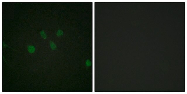 Anti-MAD1 antibody produced in rabbit affinity isolated antibody