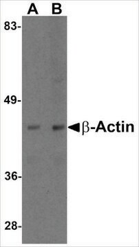 抗-&#946;-肌动蛋白 鸡抗 affinity isolated antibody, buffered aqueous solution