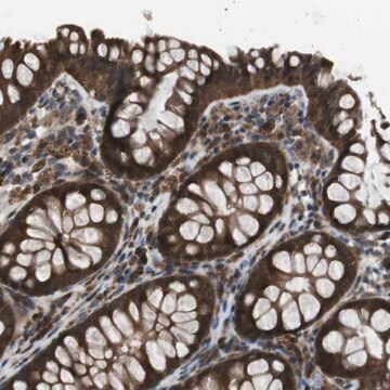 Anti-SLC22A23 antibody produced in rabbit Prestige Antibodies&#174; Powered by Atlas Antibodies, affinity isolated antibody, buffered aqueous glycerol solution