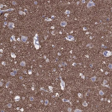 Anti-Syp Antibody Produced In Rabbit Prestige Antibodies&#174; Powered by Atlas Antibodies, affinity isolated antibody, buffered aqueous glycerol solution