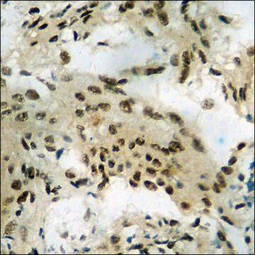 Anti-phospho-GR (pSer203) antibody produced in rabbit affinity isolated antibody