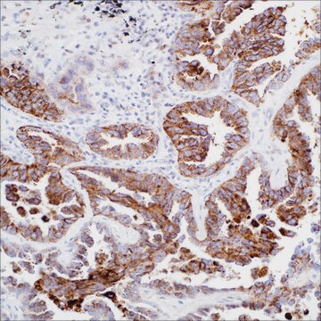 Napsin A (MRQ-60) Mouse Monoclonal Antibody