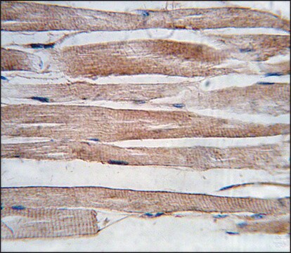 Anti-ARMC6 (center) antibody produced in rabbit saturated ammonium sulfate (SAS) precipitated, buffered aqueous solution