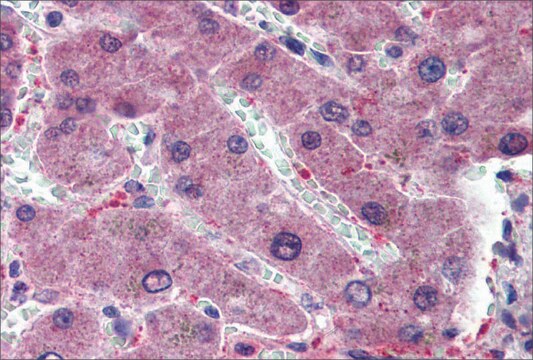 抗HYAL1抗体(ab2) ウサギ宿主抗体 affinity isolated antibody