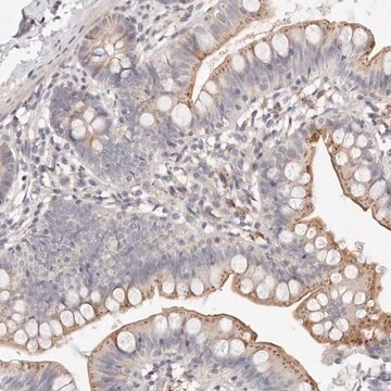 Anti-MYOM3 antibody produced in rabbit Prestige Antibodies&#174; Powered by Atlas Antibodies, affinity isolated antibody, buffered aqueous glycerol solution, ab1