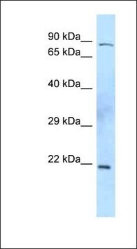 Anti-TIMP2 antibody produced in rabbit affinity isolated antibody