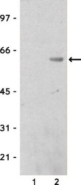 Przeciwciało anty-Calmodulin Binding Protein Epitope Tag Upstate&#174;, from rabbit