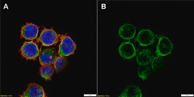 Anti-TREM-2 Antibody, clone 1I11 ZooMAb&#174; Rabbit Monoclonal recombinant, expressed in HEK 293 cells