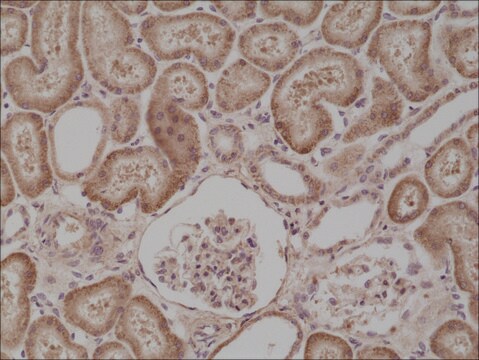 Anti-BRAFantibody, Rabbit Monoclonal recombinant, expressed in HEK 293 cells, clone RM308, purified immunoglobulin