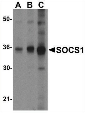 Anti-SOCS1 (ab2) antibody produced in rabbit affinity isolated antibody, buffered aqueous solution