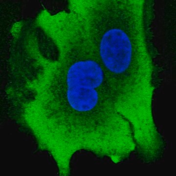 抗AKR1B10抗体 ウサギ宿主抗体 Prestige Antibodies&#174; Powered by Atlas Antibodies, affinity isolated antibody