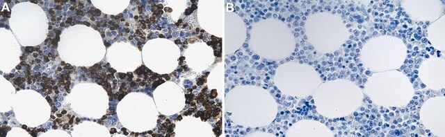 Anti-Proteinase 3/PR3 Antibody, clone 1L13 ZooMAb&#174; Rabbit Monoclonal recombinant, expressed in HEK 293 cells