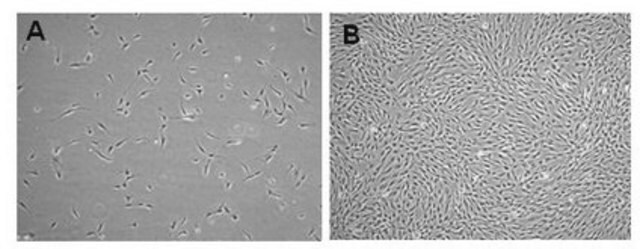 Cellule staminali mesenchimali adipose umane Human Adipose Mesenchymal Stem Cells (MSCs) are isolated from human adipose tissue and are cryopreserved at P2 to ensure optimal phenotype and the highest viability and plating efficiency.