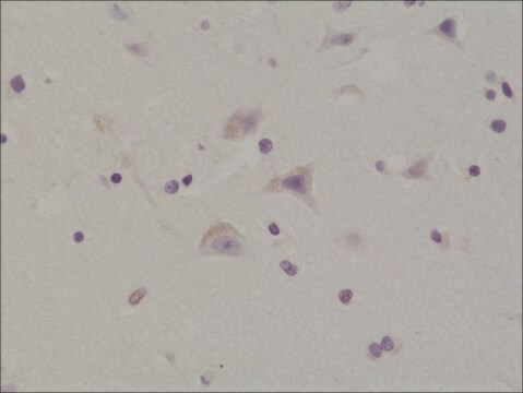 Anti-Phospho-AMPA Receptor antibody, GluR 1 subunit (Ser845), Rabbit Monoclonal recombinant, expressed in HEK 293 cells, clone RM296, purified immunoglobulin