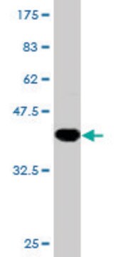 Monoclonal Anti-PPP2R2B antibody produced in mouse clone 1F3, purified immunoglobulin, buffered aqueous solution