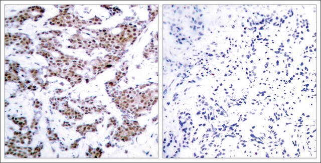 Anti-phospho-MEF2A (pThr312) antibody produced in rabbit affinity isolated antibody