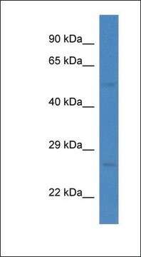 Anti-ESRRG antibody produced in rabbit affinity isolated antibody