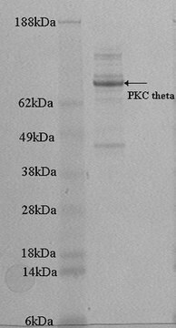 Białko PKC θ, aktywne, 10 µg Active, recombinant full-length human PKC theta with a C-terminal 6His-tag. For use in Kinase Assays.