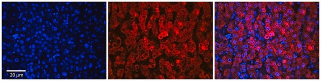 Anti-SLC37A4 antibody produced in rabbit affinity isolated antibody