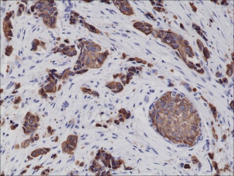 Anti-Cytokeratin 8 antibody, Rabbit monoclonal recombinant, expressed in HEK 293 cells, clone RM266, purified immunoglobulin