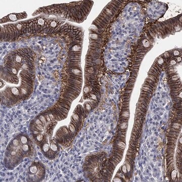 Anti-Slc2A2 Antibody Produced In Rabbit Prestige Antibodies&#174; Powered by Atlas Antibodies, affinity isolated antibody, buffered aqueous glycerol solution