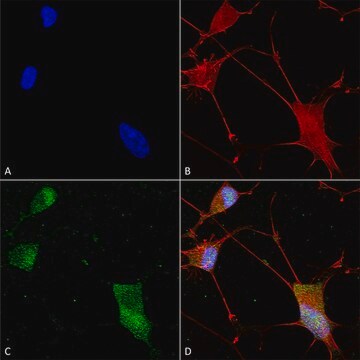 Monoklonalna anty-neuroligina- Hrp clone S110-29, purified immunoglobulin