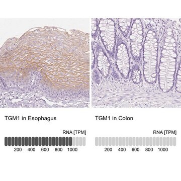 抗TGM1抗体 ウサギ宿主抗体 Prestige Antibodies&#174; Powered by Atlas Antibodies, affinity isolated antibody, buffered aqueous glycerol solution