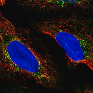 Anti-RDH5 antibody produced in rabbit Prestige Antibodies&#174; Powered by Atlas Antibodies, affinity isolated antibody