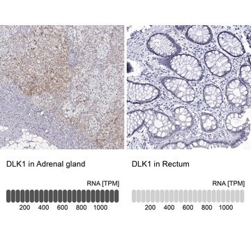 Anti-DLK1 antibody produced in rabbit Prestige Antibodies&#174; Powered by Atlas Antibodies, affinity isolated antibody, buffered aqueous glycerol solution