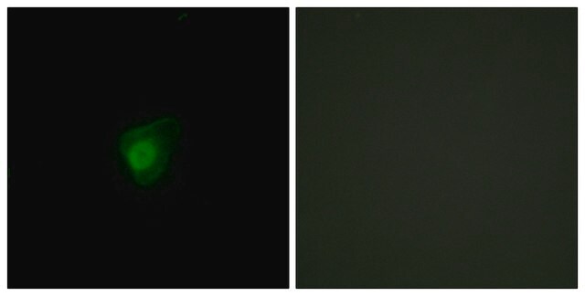 Anti-SMG7 antibody produced in rabbit affinity isolated antibody