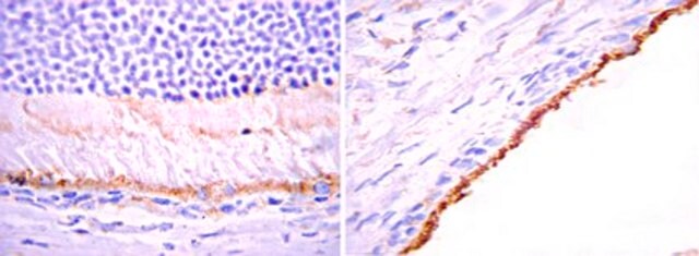 Anti-Bestrophin-Antikörper Chemicon&#174;, from mouse