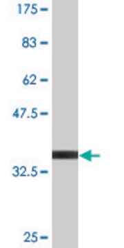 Monoclonal Anti-S100A11 antibody produced in mouse clone 1B12, purified immunoglobulin, buffered aqueous solution