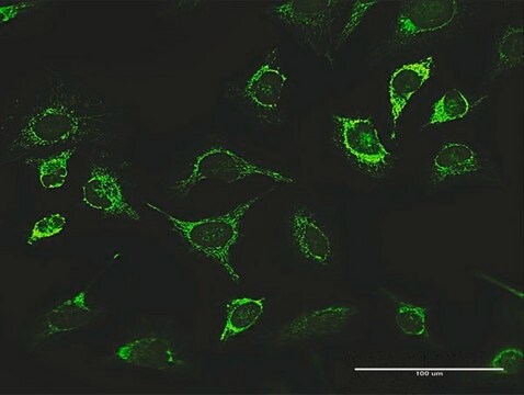 抗LONP1抗体 ウサギ宿主抗体 purified immunoglobulin, buffered aqueous solution