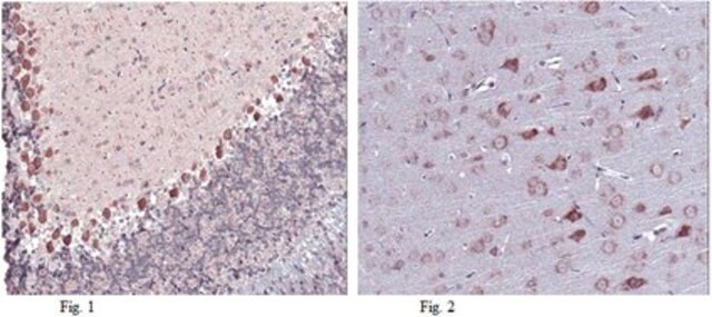 Anti-LGI1 Antibody from rabbit