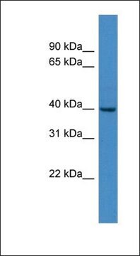 抗FKHL18抗体 ウサギ宿主抗体 affinity isolated antibody