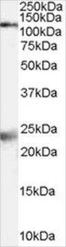 抗NMDAレセプター 1/GRIN1 ヤギ宿主抗体 affinity isolated antibody, buffered aqueous solution