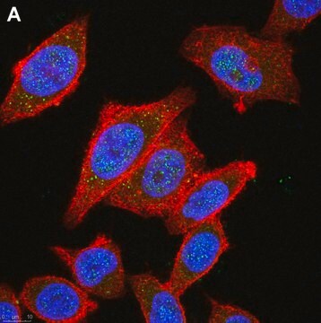 Anti-HDAC4 Antibody, clone 1C16 ZooMAb&#174; Rabbit Monoclonal recombinant, expressed in HEK 293 cells