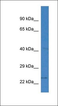 Anti-SLC10A2 antibody produced in rabbit affinity isolated antibody