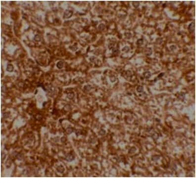 Anti-EPAC2 Antibody from rabbit, purified by affinity chromatography