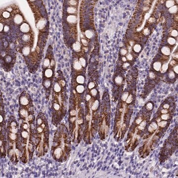 Anty-L2HGDH Prestige Antibodies&#174; Powered by Atlas Antibodies, affinity isolated antibody, buffered aqueous glycerol solution