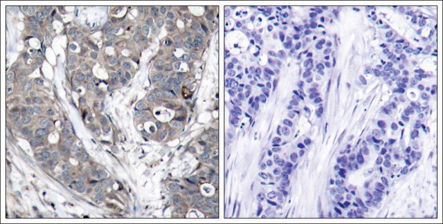 Anti-HSPB1 (Ab-78) antibody produced in rabbit affinity isolated antibody