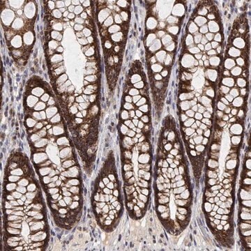 Anti-GADD45GIP1 antibody produced in rabbit Prestige Antibodies&#174; Powered by Atlas Antibodies, affinity isolated antibody, buffered aqueous glycerol solution