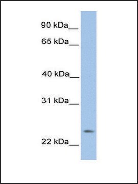 Anti-ORAI1 (AB1) antibody produced in rabbit affinity isolated antibody