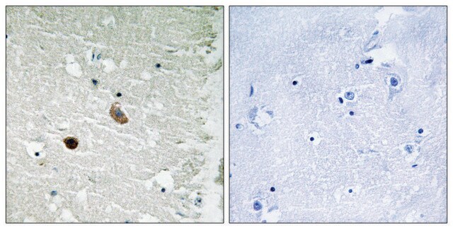 Anti-CAMK2 antibody produced in rabbit affinity isolated antibody