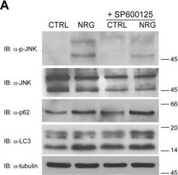 Monoklonales Anti-&#946;-Tubulin-I in Maus hergestellte Antikörper clone SAP.4G5, ascites fluid