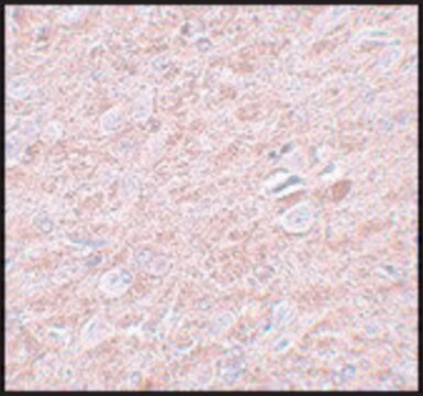 Anti-PRDM16 antibody produced in rabbit affinity isolated antibody