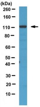 Anti-phospho-CYLD Antibody (Ser418) serum, from rabbit