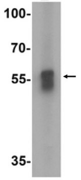 Przeciwciało anty-TFEB from rabbit, purified by affinity chromatography