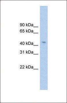 Anti-RG9MTD1 antibody produced in rabbit affinity isolated antibody