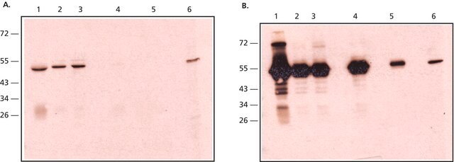 Monoclonal Anti-Rabbit IgG, Native in Maus hergestellte Antikörper clone RabT-50, purified from hybridoma cell culture